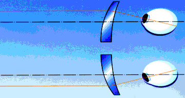 prismenbrillen.gif undefined